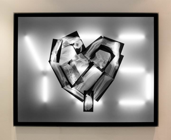james-clar-for-you-anything-2010-medical-x-rays-acrylic-fl-tubes-155-x-120-cm